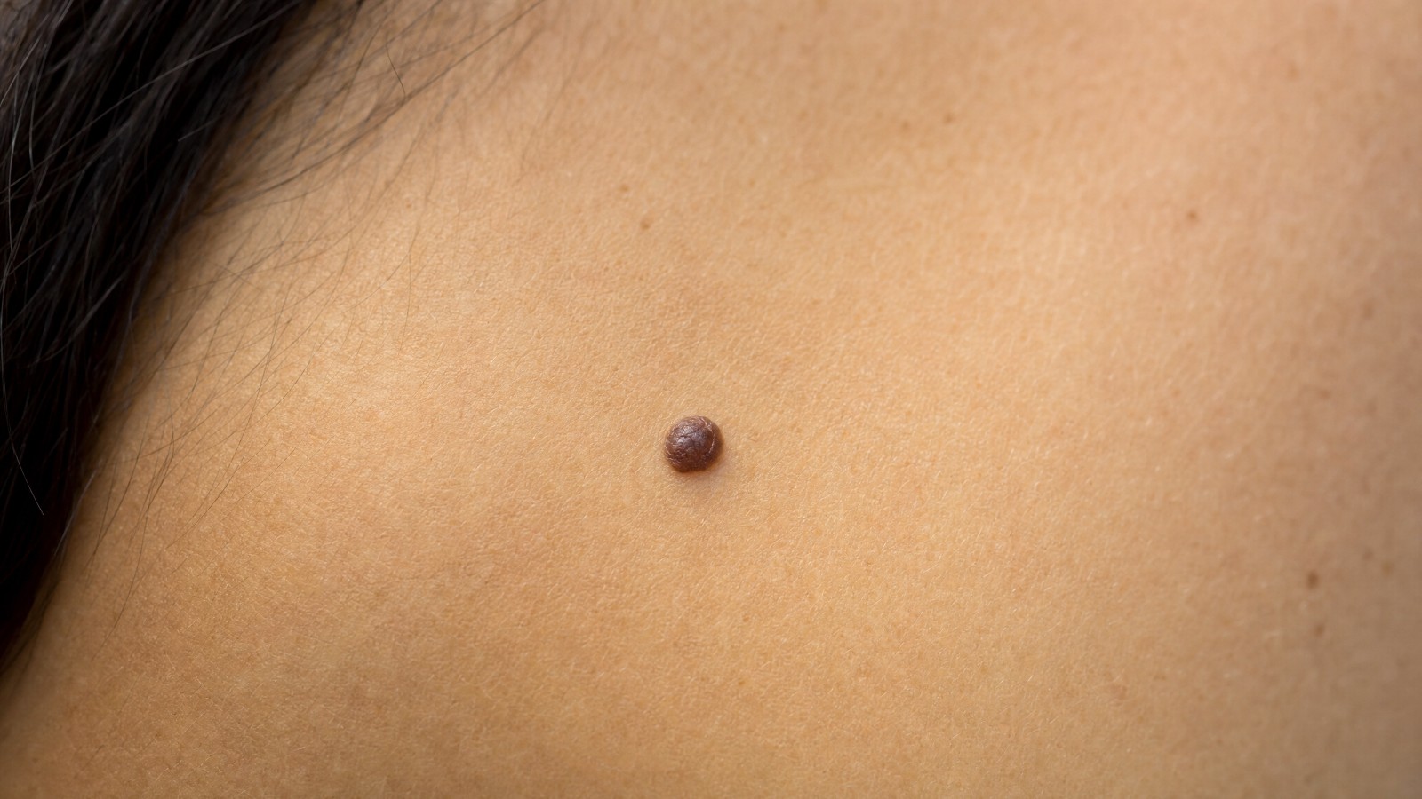Mole Removal in Wirral: Check, Remove and Test