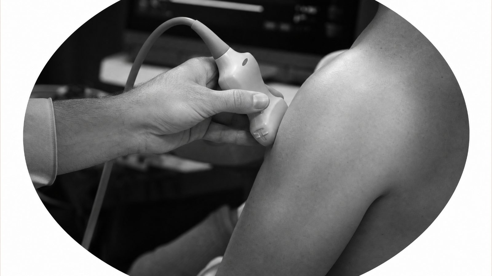 Clinician applying an ultrasound probe to a patient's knee
