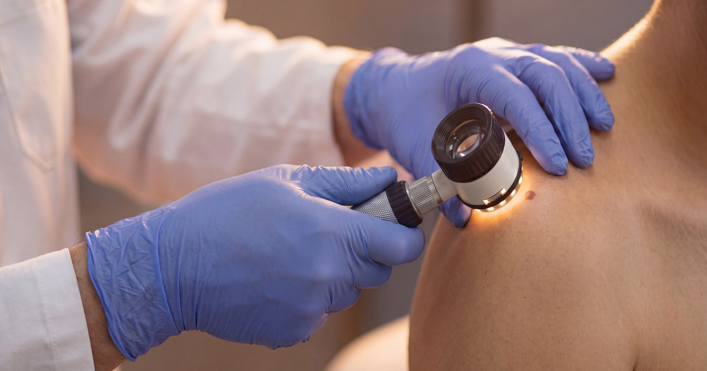 Minor Skin Surgery in Wirral · Skin & Joint Injection Clinic